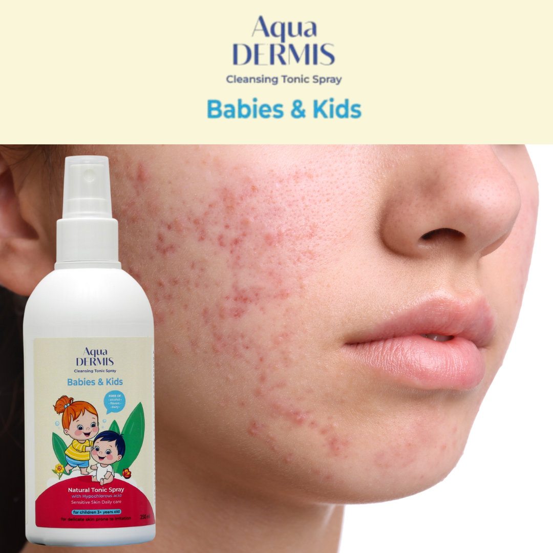 Bruma Suave con HOCl para Bebés y Niños – Spray Hidratante y Seguro (250 ml)