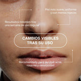 AquaDERMIS Kit Diario – Tónico Facial con Ácido Hipocloroso y Nano Pulverizador - Sterilox C&B Europe SL