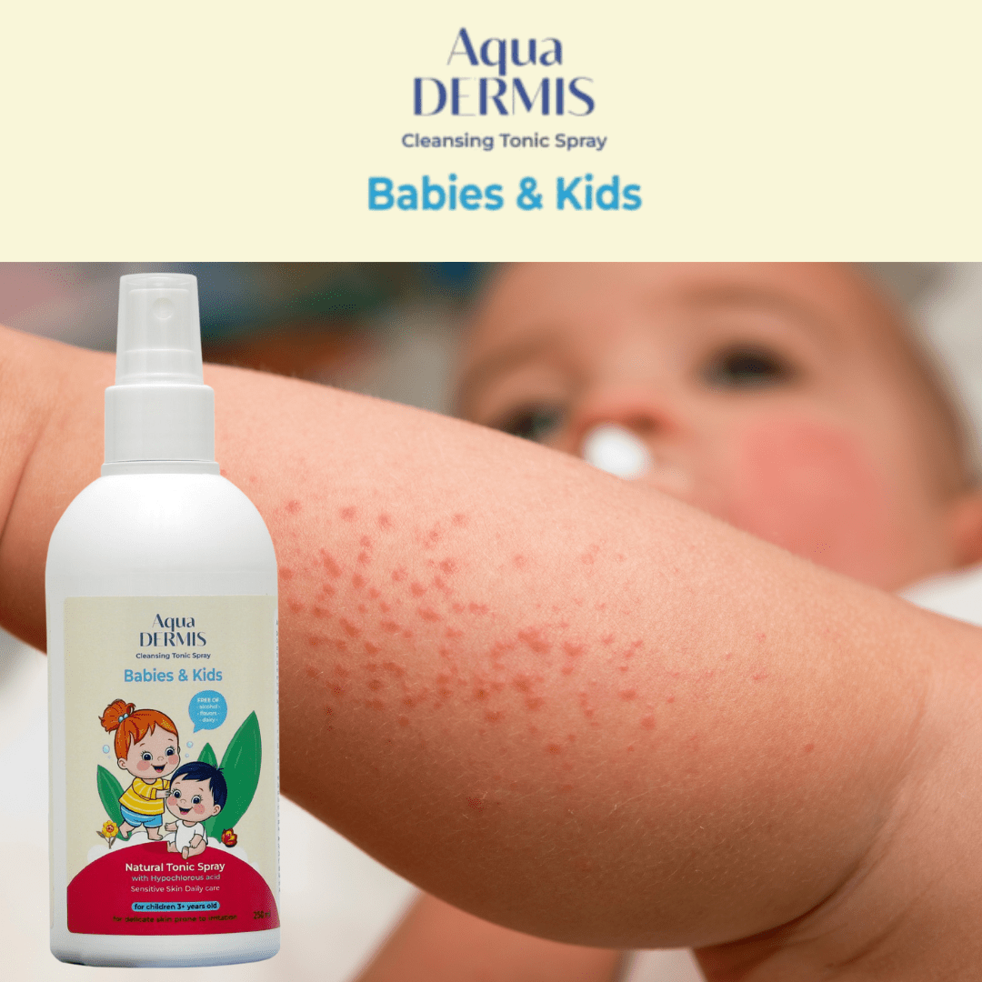 Bruma Suave con HOCl para Bebés y Niños – Spray Hidratante y Seguro (250 ml) - Sterilox C&B Europe SL